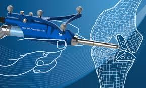 Advanced Robotic Surgery