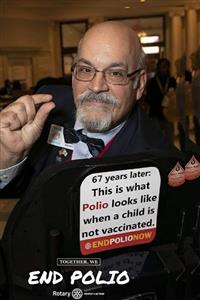 polio - we need to iradicate it